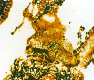 erradicacion_helicobacter_pylori/mucus_mucosa_gastrica erradicacion_helicobacter_pylori/mucus_mucosa_gastrica