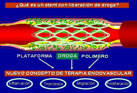 stents_liberadores_drogas/actp_liberacion_farmacos