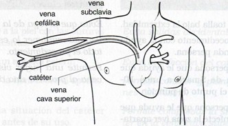 conversion_via_periferica_central/anatomia_cateter_subclavia_cava_superior
