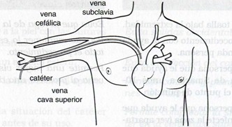 conversion_via_periferica_central/anatomia_cateter_subclavia_cava_superior conversion_via_periferica_central/anatomia_cateter_subclavia_cava_superior