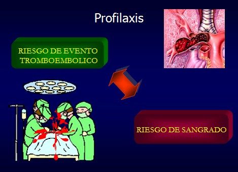 TEP_tromboembolismo_pulmonar/profilaxis_prevencion_embolia TEP_tromboembolismo_pulmonar/profilaxis_prevencion_embolia