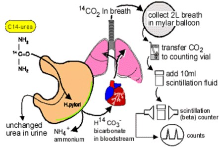 helicobacter_pylori/prueba_del_aliento