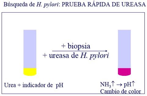 helicobacter_pylori/prueba_rapida_ureasa