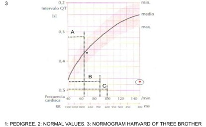 diversidad_sistole_electrica/ECG_EKG