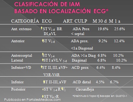 infarto_agudo_miocardio/ECG_localizacion_infarto