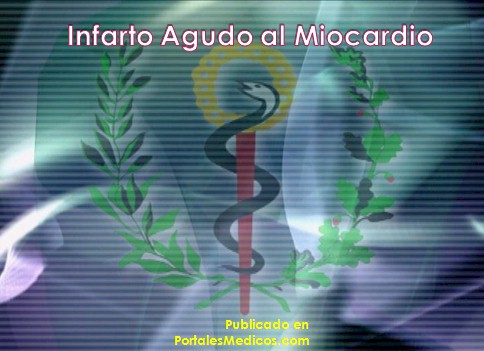 infarto_agudo_miocardio/IAM_revision