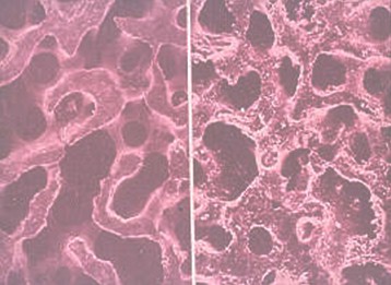 sustituto_tejido_oseo/hidroxiapatita_histologia_microscopio sustituto_tejido_oseo/hidroxiapatita_histologia_microscopio