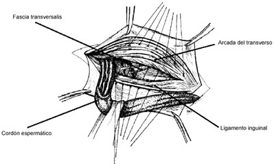 hernias_inguinales/operacion_de_bassini