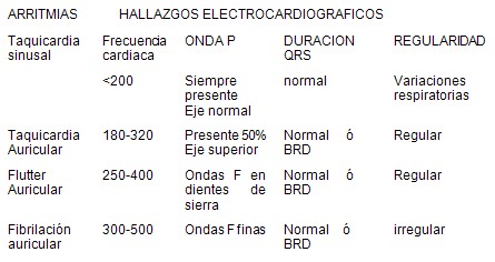 taquiarritmias_pediatria/diagnostico_taquicardias_ECG taquiarritmias_pediatria/diagnostico_taquicardias_ECG