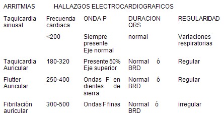 taquiarritmias_pediatria/diagnostico_taquicardias_ECG