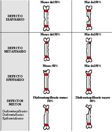 evaluacion_anatomofuncional_tibia/clasificacion_defecto_oseo