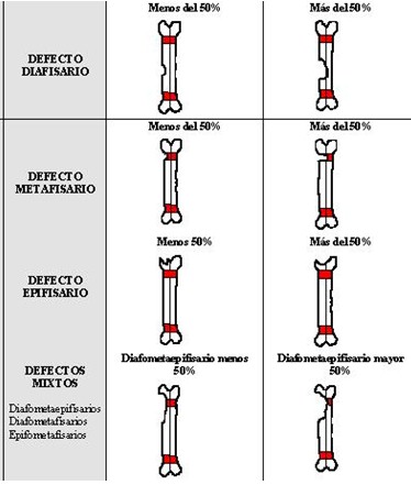 evaluacion_anatomofuncional_tibia/clasificacion_defecto_oseo evaluacion_anatomofuncional_tibia/clasificacion_defecto_oseo