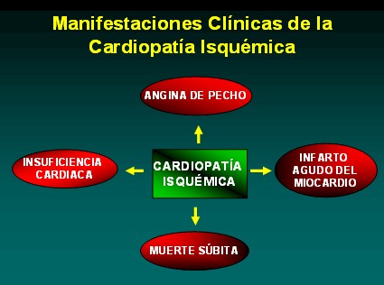 farmacologia_terapeutica_antianginosa/clinica_cardiopatia_isquemica