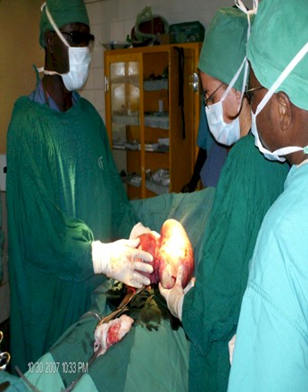 ovarian_fibroid_pregnancy/surgery_findings ovarian_fibroid_pregnancy/surgery_findings