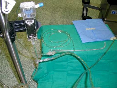 quimioterapia_intraperitoneal_hipertermia/circuito_perfusion_cardioplegia