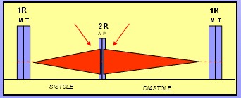 cardiopatias_congenitas/anomalia_ebstein_auscultacion