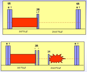 cardiopatias_congenitas/auscultacion_comunicacion_interventricular