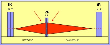 cardiopatias_congenitas/exploracion_auscultacion_ductus cardiopatias_congenitas/exploracion_auscultacion_ductus