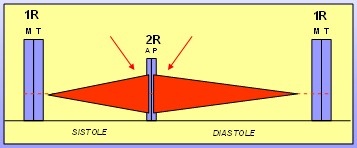 cardiopatias_congenitas/exploracion_auscultacion_ductus