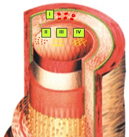 cardiopatias_congenitas/hipertension_pulmonar