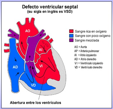 cardiopatias_congenitas/oximetria_flujo_oxigenacion