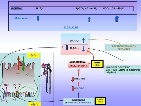 equilibrio_acido_base/alcalosis_metabolica equilibrio_acido_base/alcalosis_metabolica