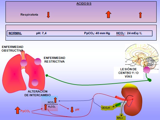 equilibrio_acido_base/alteracion_desequilibrio_descompensacion