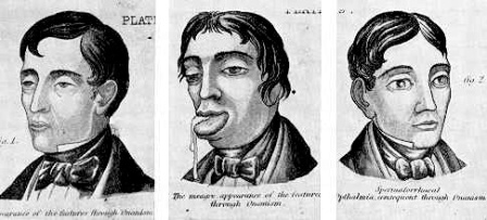 historia_tendencia_circuncision/r_l_perry historia_tendencia_circuncision/r_l_perry