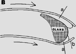 historia_tendencia_circuncision/restauracion_prepucio3.