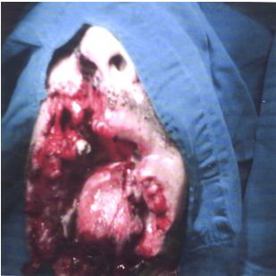 herida_arma_fuego/preoperatorio_1 herida_arma_fuego/preoperatorio_1