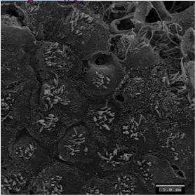 imagenes_cientificas_histologia/brotes_verdes