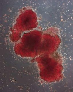 imagenes_cientificas_histologia/globulos_rojos