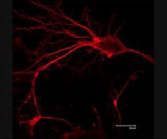 imagenes_cientificas_histologia/neurona_neuroesferas