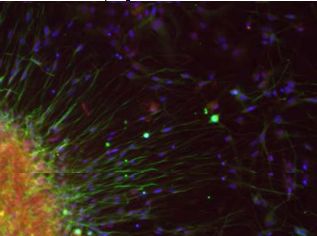 imagenes_cientificas_histologia/neuronas_serotoninergicas