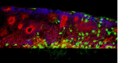 imagenes_cientificas_histologia/tejido_retiniano