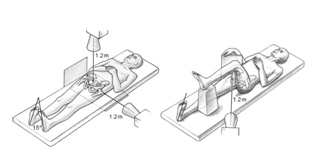 artroscopia_atrapamiento_femoroacetabular/proyeccion_de_dumm