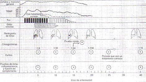 complicaciones_neurologicas_micoplasma/manifestaciones_clinicas_pneumoniae