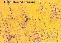 Universidad_Padua_Medicina/golgi_stained_neurons