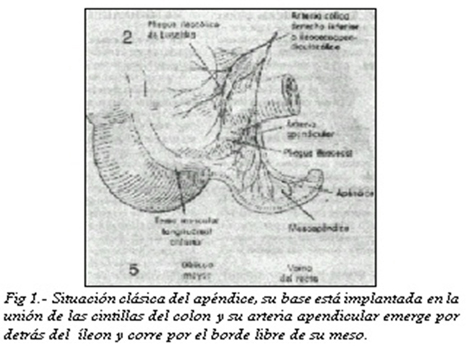 apendicitis_aguda_cirugia/situacion_clasica_apendice