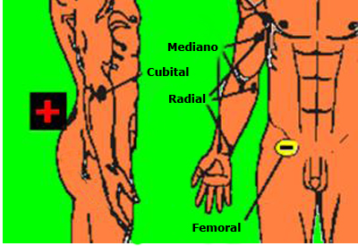 corrientes_excitomotrices/tecnicas_estimulacion_monopolar