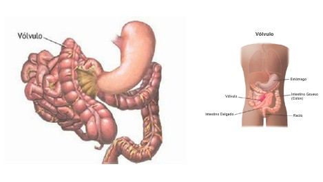 volvulus_volvulo_intestino/delgado_anatomia_cirugia