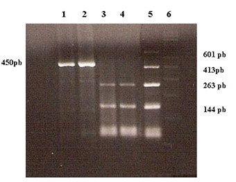papilomavirus_humano_pterigium/deteccion_vph_pcr papilomavirus_humano_pterigium/deteccion_vph_pcr