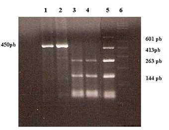 papilomavirus_humano_pterigium/deteccion_vph_pcr