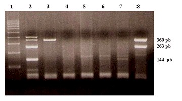 papilomavirus_humano_pterigium/tipificacion_pcr_multiplex. papilomavirus_humano_pterigium/tipificacion_pcr_multiplex.