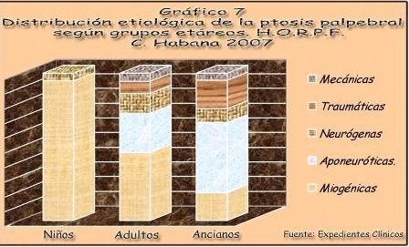 tratamiento_ptosis_palpebral/distribucion_etiologica_etareo