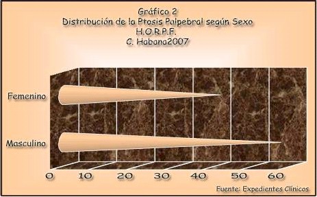 tratamiento_ptosis_palpebral/ptosis_segun_sexo