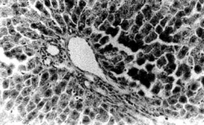 enfermedad_venooclusiva_hepatica/microfotografia_rata_control enfermedad_venooclusiva_hepatica/microfotografia_rata_control