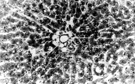 enfermedad_venooclusiva_hepatica/rata_busulfan_fragmentacion enfermedad_venooclusiva_hepatica/rata_busulfan_fragmentacion