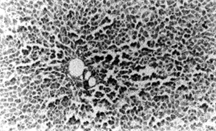 enfermedad_venooclusiva_hepatica/rata_busulfan_necrosis enfermedad_venooclusiva_hepatica/rata_busulfan_necrosis