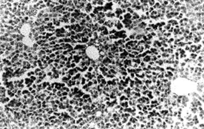 enfermedad_venooclusiva_hepatica/rata_busulfan_parenquima enfermedad_venooclusiva_hepatica/rata_busulfan_parenquima
